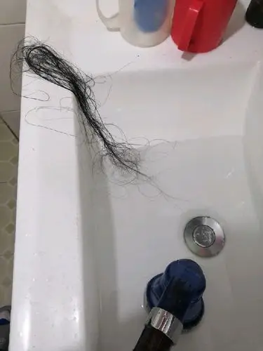 生完娃头发掉光了