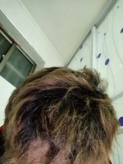 柔顺药水待在头发时间太长了,焦了,怎么办?求专业人士解答.重谢