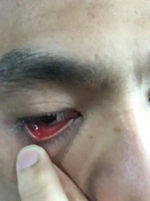 眼里的白点是什么鬼.像逗逗,准备晚上用针挑了,.