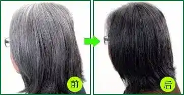 十年白发变黑发她到底做了什么