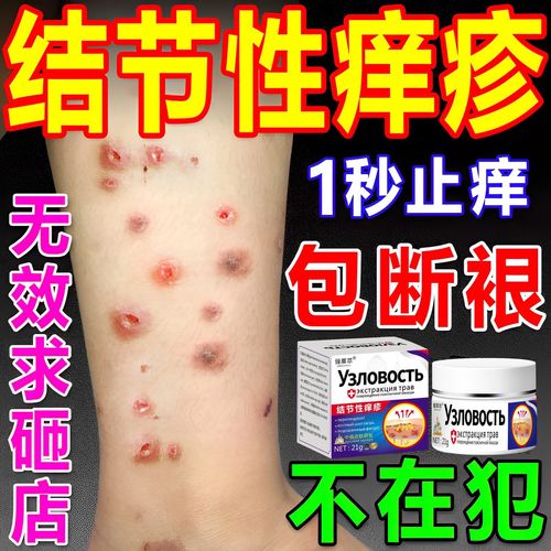 皮肤瘙痒止痒膏特效过敏杀菌