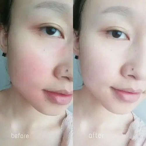 能改善脸部皮肤颜色不均,皮肤越抹越白,就像打了水光针,再熬夜也不怕