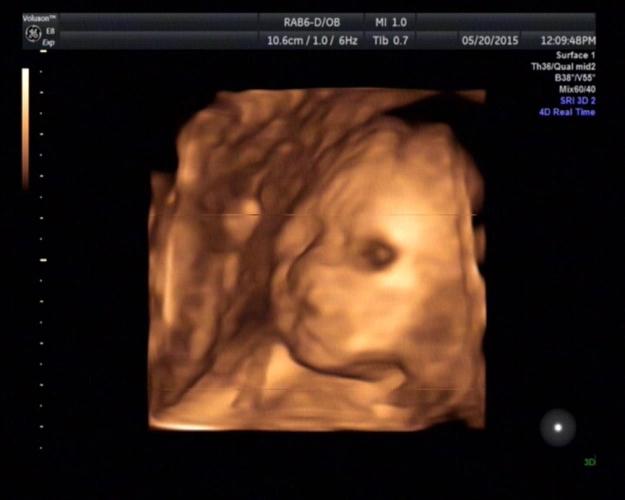 我的宝宝这是睁着眼睛吗?