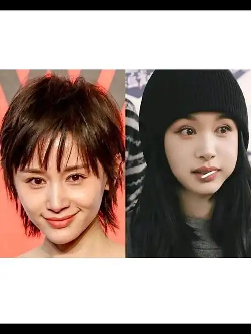 同样是面部填充,为什么王子文那么成功呢?