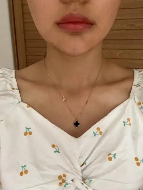 硅胶垫下巴天又尖又长好像还有点歪怎么办啊