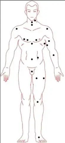 全身痣相图解,可参考【男人全身痣相图解】和【女人全身痣相图解】 本