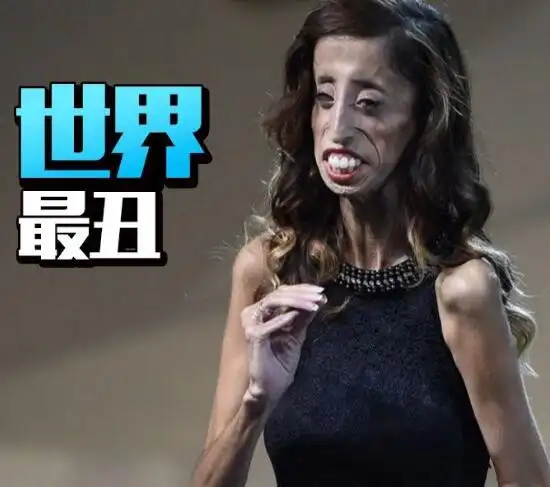 世界上最丑女人,丽兹·维拉斯奎兹(先天畸形/人虽丑但很励志)
