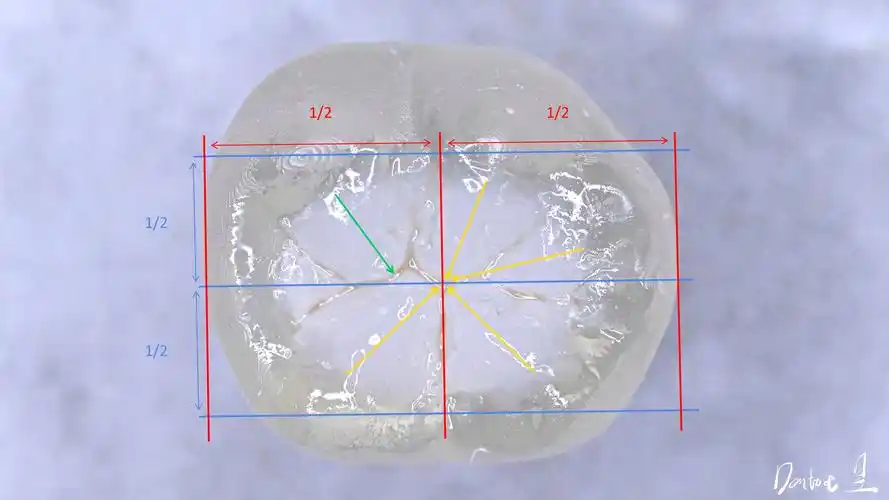 下颌第一磨牙形态解析