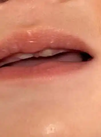 7个月宝宝老是低烧反复,这牙齿旁边是长了什么东西 有知道的吗?