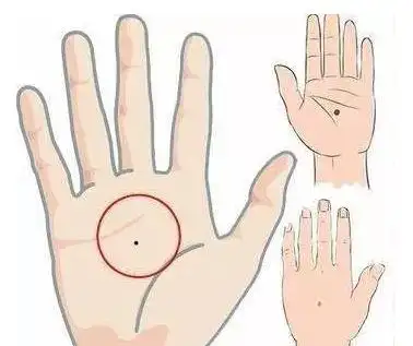 手掌心有痣代表什么?