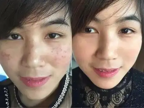 美白去黄淡斑的护肤产品哪些好?