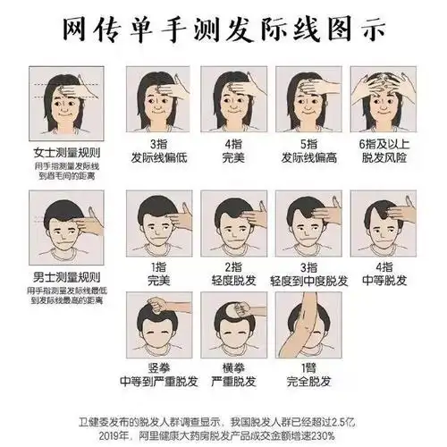 张东升"拍了拍"你的秃头,你的发际线还好吗