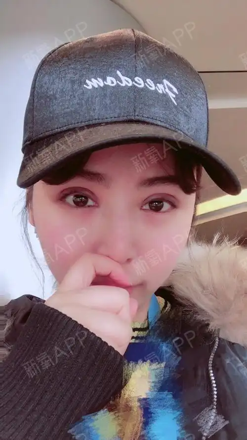 北京切开双眼皮好不好_效果图_rainbowli切开双眼皮术后第20天_新氧