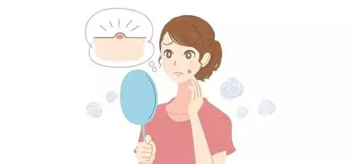 普大喜奔·皮肤科开设"痤疮"和"毛发疾病"专病门诊啦!