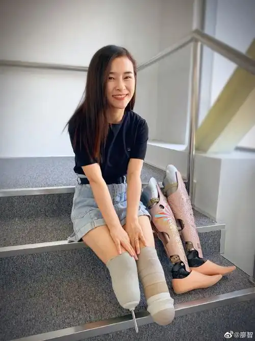 汶川地震13年那个经历双腿截肢的女舞者如今还翩翩起舞吗