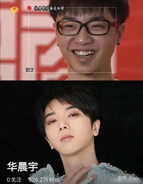 如何看待关于华晨宇整容的爆料? - 知乎