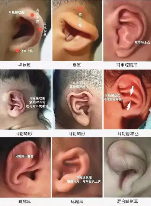 耳朵形状分类