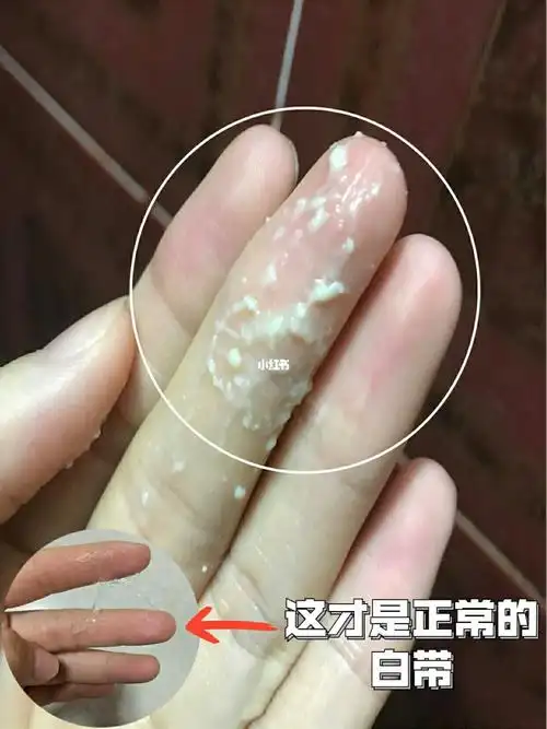 妇科炎症_护垫_内裤_炎症_胡桃里怎么样_洗液_洗衣皂_植物提取_杀菌