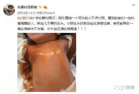刚出生的女宝宝左侧乳房没了就因为