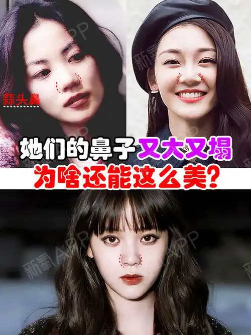 塌鼻梁大鼻子女生面相_鼻梁塌的女人命运怎样_鼻梁塌女人面相
