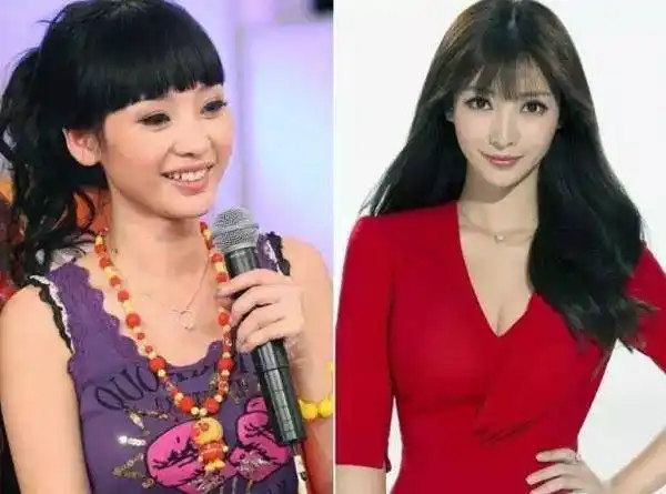柳岩整容如家常便饭 网友:整容不要紧千万别整胸