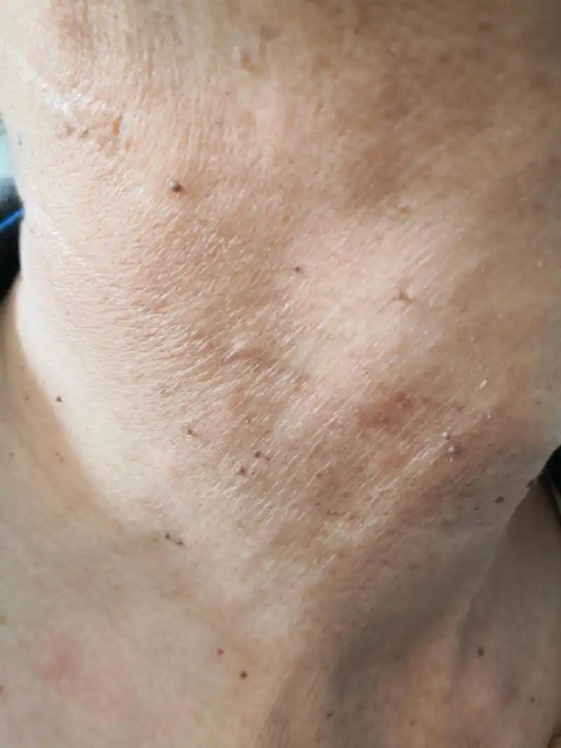 皮赘##解决皮肤问题专注皮肤美容##纪秀军皮肤科专家的访谈