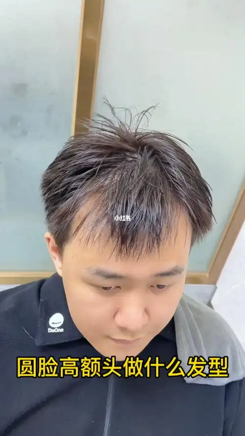 男孩子头发少额头高适合什么发型