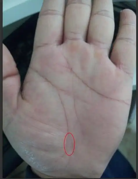 生命线尾部分叉图解