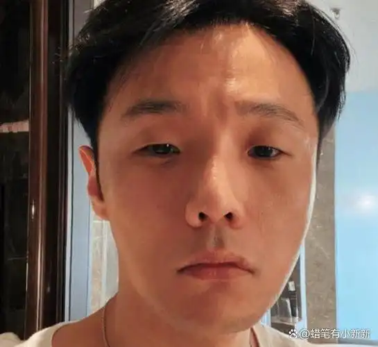小眼睛李荣浩变双眼皮是啥样?看到最后效果,演反派都不用化妆了