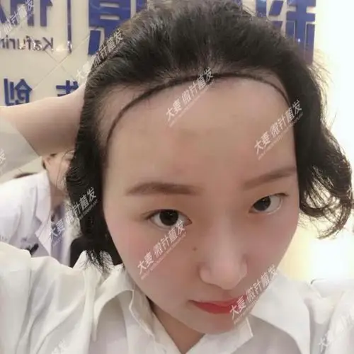 大秃头变身密发少女