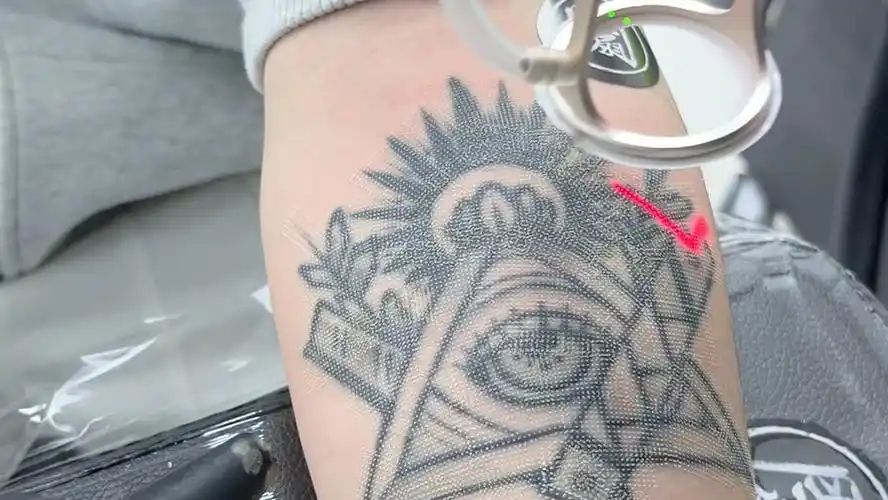 清洗小臂上帝之眼,洗纹身过程记录