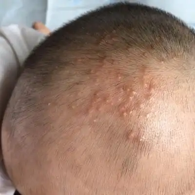 问答 婴儿期0-1岁 果肉-candy3个月25天2016-07-01 推荐回答