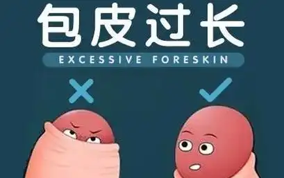 包皮手术后应注意这10个问题