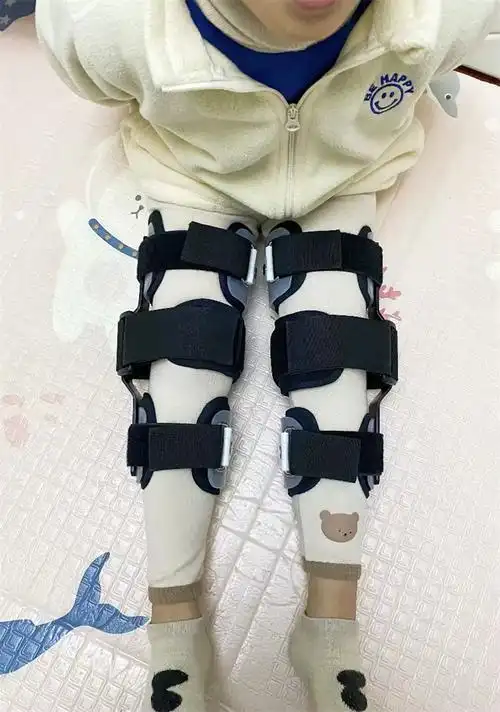 善易保健器械店 儿童xo型腿器纠正膝内外翻小腿外翻绑腿带罗圈腿支具