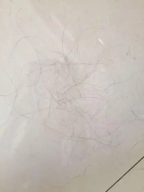 最近一掉一大把.黑黑的连根掉.或者扎完头发放下来也是掉一大把.一天