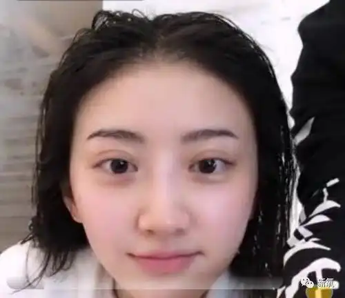 李小璐2米宽的双眼皮竟然变窄了