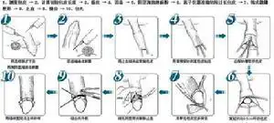 韩式微雕包皮环切术