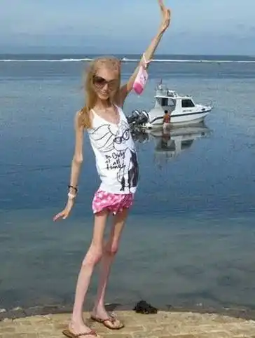 6条腿,4乳房,24指.太吓人!