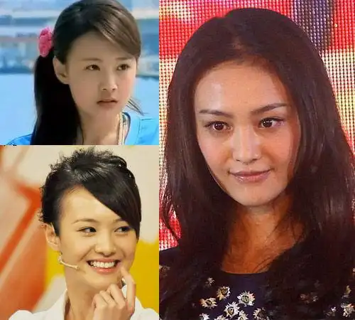 郑爽自爆整容心路历程 短期不会再动刀|郑爽整容|郑爽整容前后|郑爽