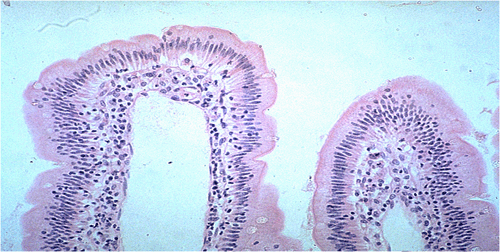 绒毛中含淋巴液的乳糜管
