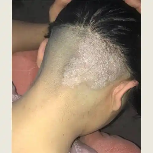 去头皮屑的洗发水推荐