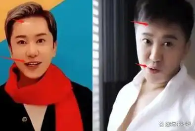 那些整了容的男明星,忍了古天乐和陈浩民,看到毛宁我忍不住了