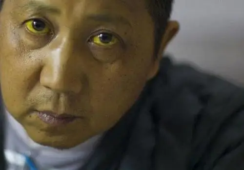 这7个身体的微妙变化,每一个都是肝癌的前奏