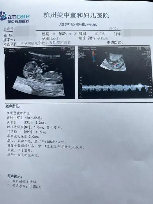 nt秒过啦人见人说是女儿72