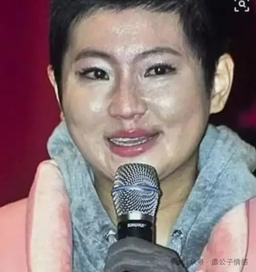 毁容被前夫嫌"想吐",现与小7岁男友未婚生子|张承中|田馥甄|陈嘉桦|s