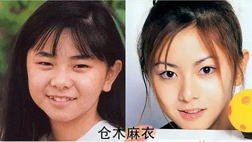 日本整容术是保留底子的变美