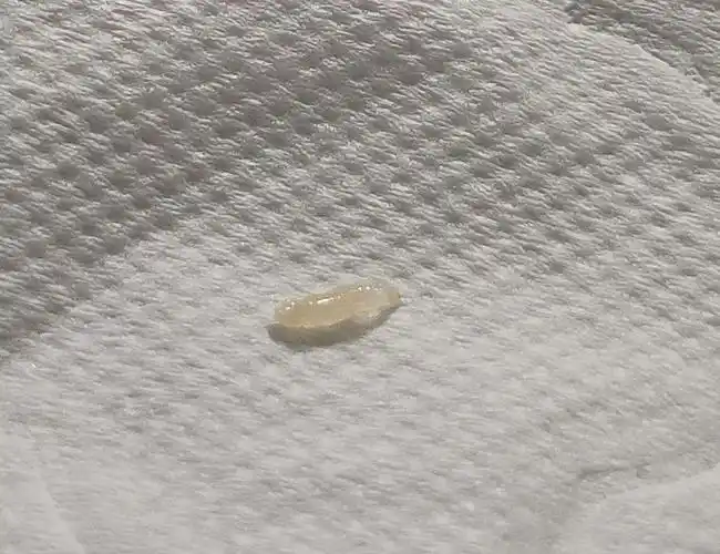 慎入,这个可以蠕动的白色虫子是啥