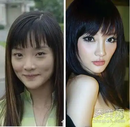 李小璐袁姗姗杨幂小s 揭女星动刀整容部位