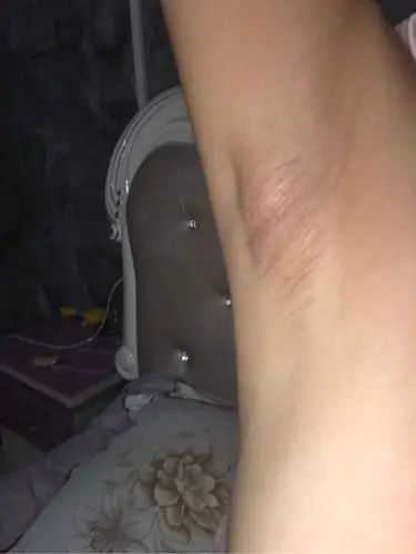 最近腋下长得有像肿块的东西_妈妈网轻聊_千万女人的共同选择