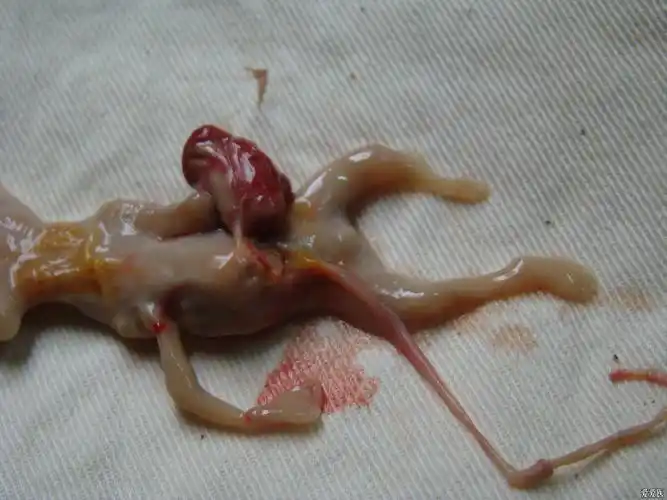 社保生育险怎么报销 社保里的生育险死胎引产能报吗